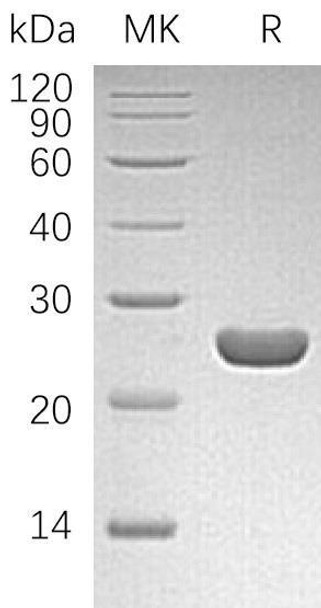 Human HPGDS/GSTS Recombinant Protein (RPES0453)