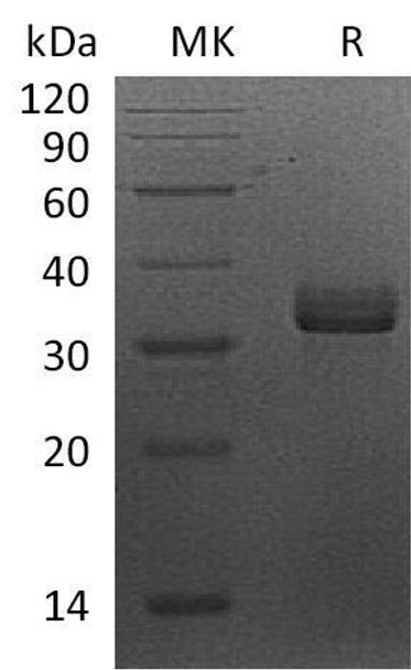 Human Syntaxin-7/STX7 Recombinant Protein (RPES0455)