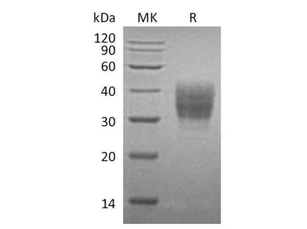 Mouse SLAMF7/CD319 Recombinant Protein (RPES0459)