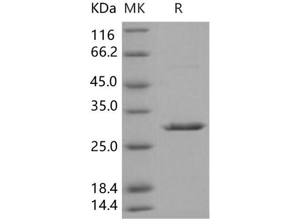 Human 14-3-3 beta/YWHAB Recombinant Protein (RPES0464)