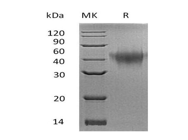 Mouse TNFRSF1B/CD120b Recombinant Protein (RPES0477)