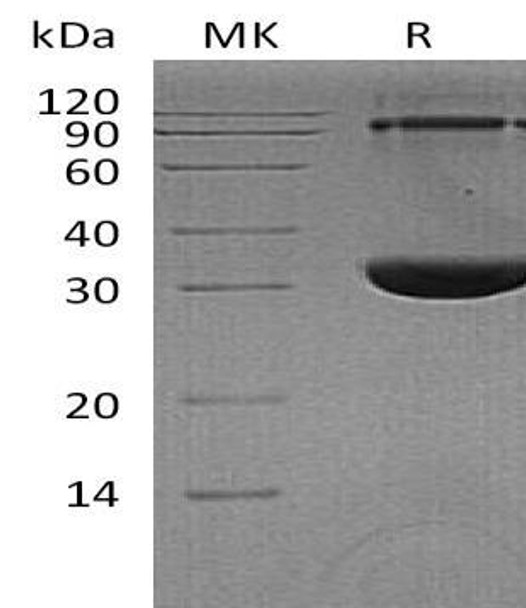 Human Syntenin/SDCBP Recombinant Protein (RPES0493)