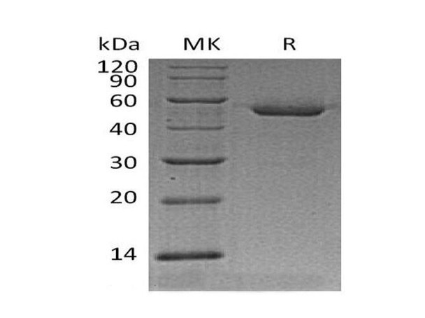 Mouse Cathepsin D/CTSD Recombinant Protein (RPES0497)