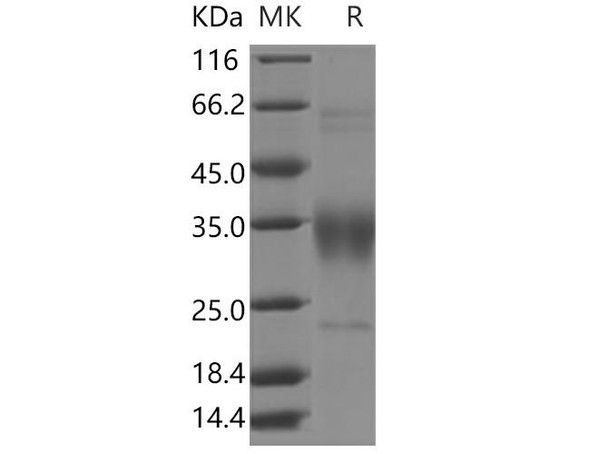 Human CD47 Recombinant Protein  (RPES0500)