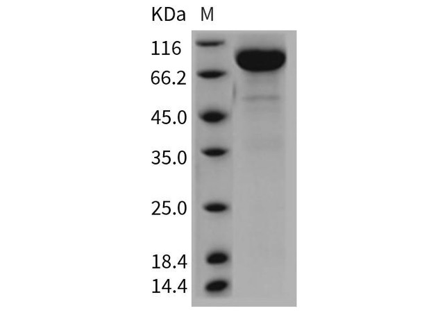 Rat IL13RA2/CD213A2 Recombinant Protein (RPES0504)