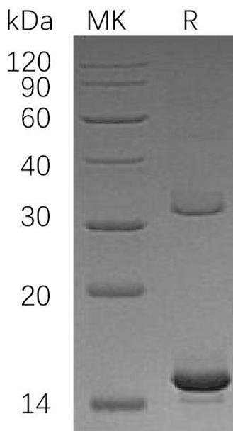 Human HBAZ Recombinant Protein (RPES0510)