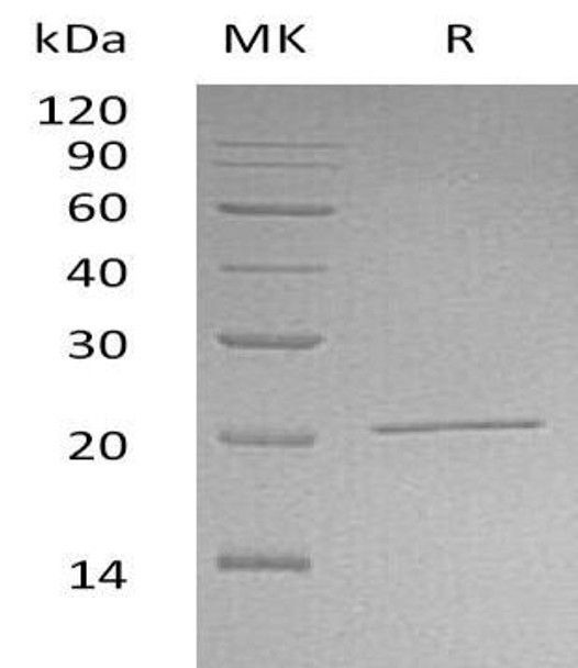 Human NIP7/KD93 Recombinant Protein (RPES0511)