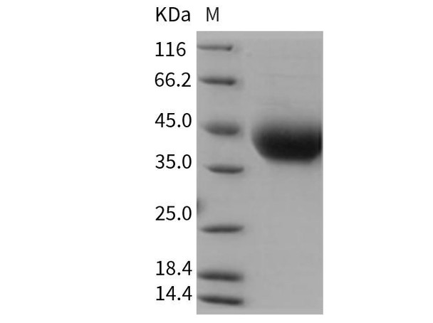 Rat IL4RA/CD124 Recombinant Protein (RPES0524)