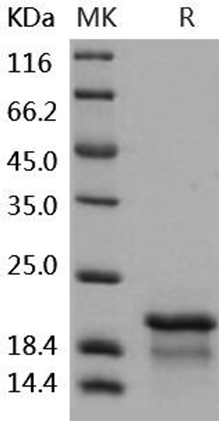 Human NPM1/Nucleophosmin Recombinant Protein (RPES0528)