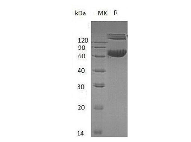 Mouse Ephrin-B1/EFNB1 Recombinant Protein (RPES0534)
