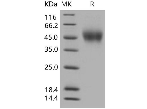 Human CD150/SLAMF1 Recombinant Protein (RPES0541)