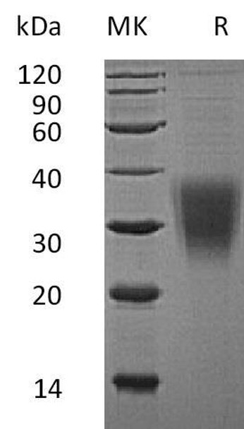 Human CD159a/KLRC1 Recombinant Protein (RPES0549)