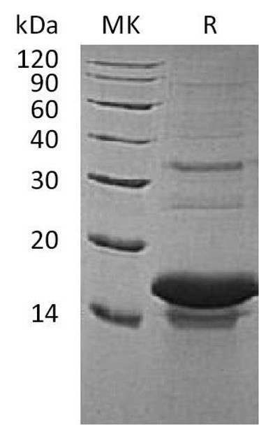 Human Tachykinin-3/TAC3 Recombinant Protein (RPES0550)