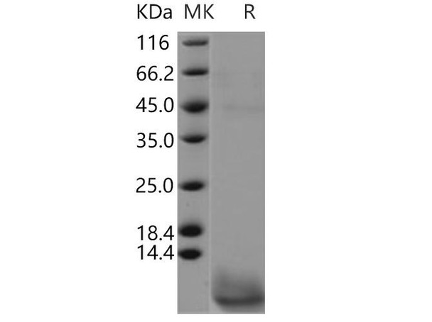 Human CART/CARTPT Recombinant Protein (RPES0558)