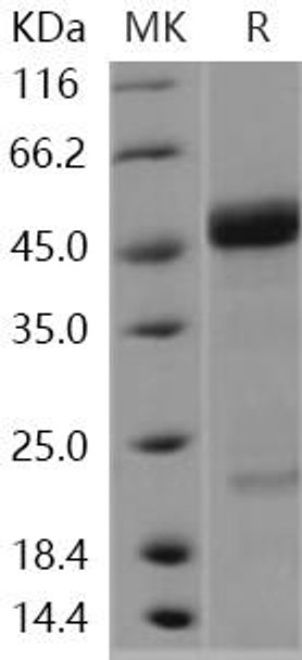 Human AGER/RAGE Recombinant Protein  (RPES0559)