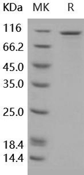 Human EphB6 Recombinant Protein (RPES0561)