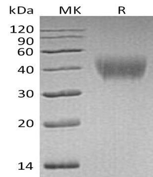 Human HEPACAM Recombinant Protein (RPES0567)