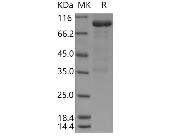 Human LRP10 Recombinant Protein (RPES0577)