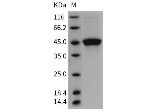Rat GITR/TNFRSF18 Recombinant Protein (RPES0581)
