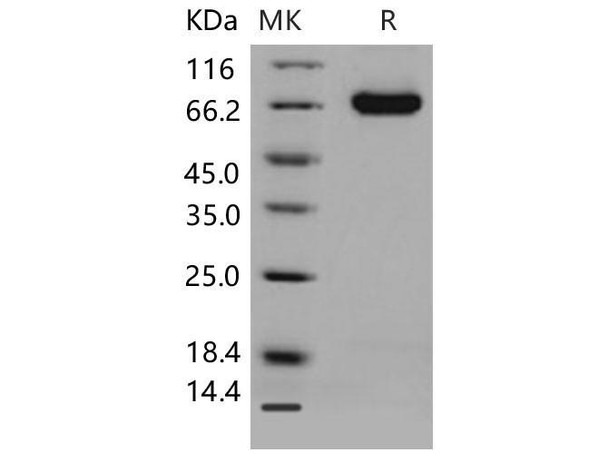 Mouse DLL4 Recombinant Protein (RPES0582)
