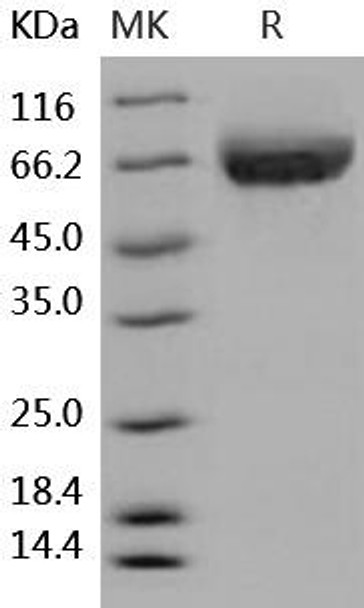 Human ALCAM/CD166 Recombinant Protein (RPES0584)