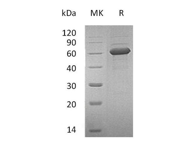 Human NKG2DL/ULBP Recombinant Protein (RPES0587)