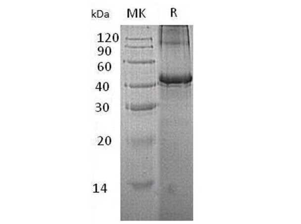 Human Testin/TES Recombinant Protein (RPES0588)