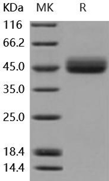 Mouse IL13RA2/CD213A2 Recombinant Protein (RPES0602)