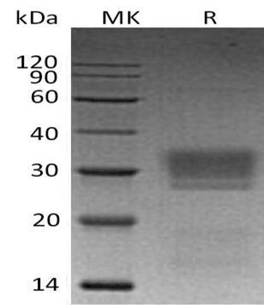 Human ULBP2/N2DL-2 Recombinant Protein (RPES0606)