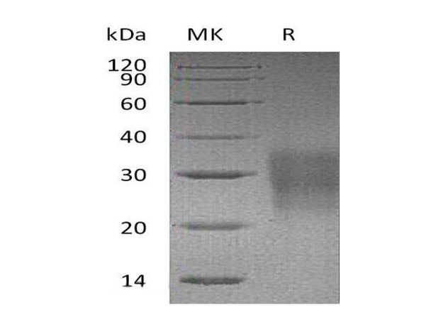 Mouse FAS/TNFRSF6 Recombinant Protein (RPES0611)