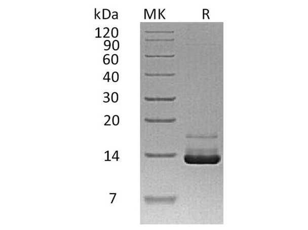 Parathyroid Hormone/PTH Recombinant Protein (RPES0612)