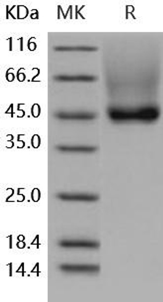 Human Decorin/DCN Recombinant Protein (RPES0618)