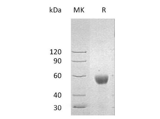 Human ULBP2/N2DL-2 Recombinant Protein (RPES0626)
