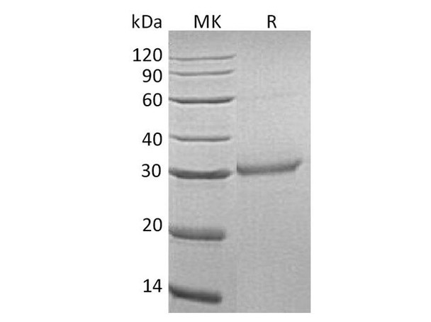 Human OLR1/LOX1 Recombinant Protein (RPES0632)