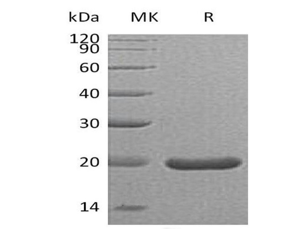 Mouse SHH (C25II) Recombinant Protein  (RPES0633)