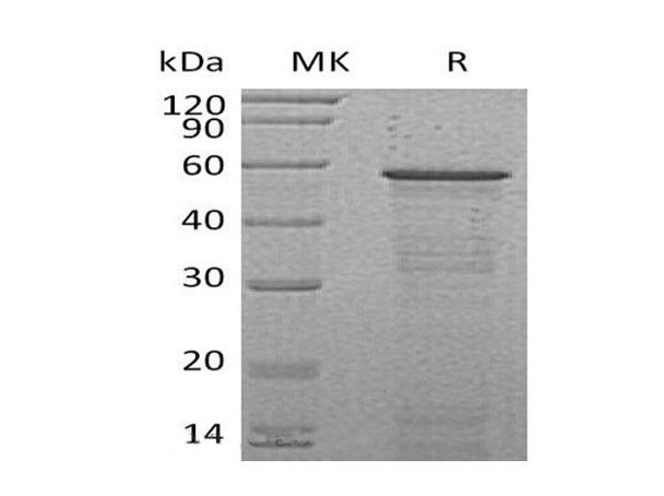 Mouse HCFC2 Recombinant Protein (RPES0634)