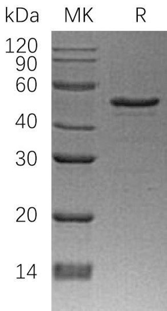 Human NDRG1 Recombinant Protein (RPES0646)