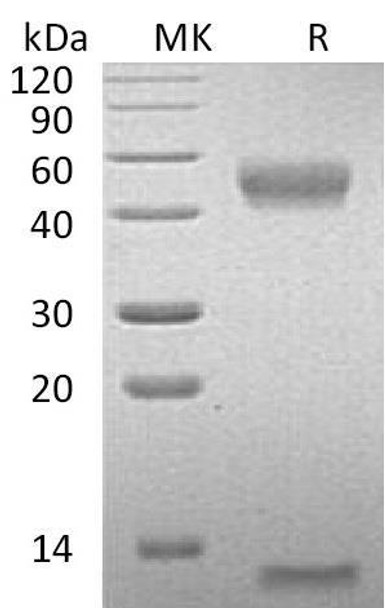 Mouse FcRn & B2M Heterodimer Recombinant Protein (RPES0649)