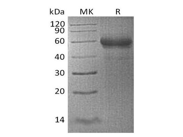 Human TNFSF4/OX40L Recombinant Protein (RPES0652)