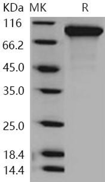 Human Neuroligin 1/NLGN1 Recombinant Protein (RPES0656)