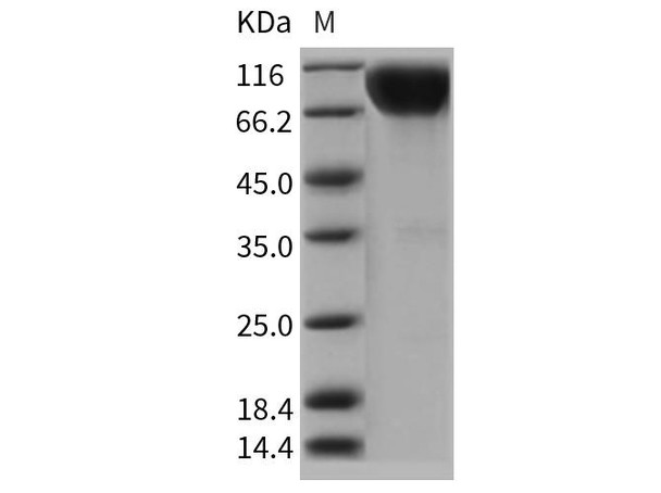 Rat IL17RA Recombinant Protein (RPES0659)