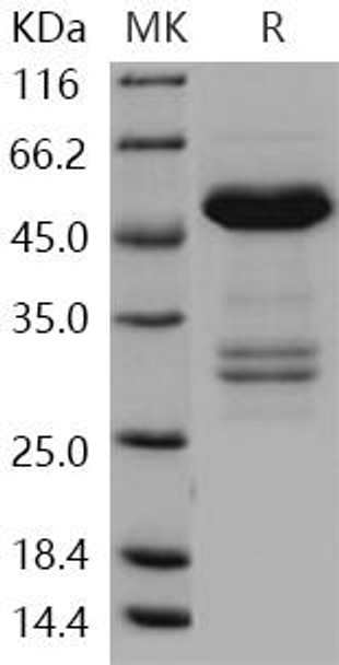 Human TWF1/Twinfilin Recombinant Protein (RPES0661)