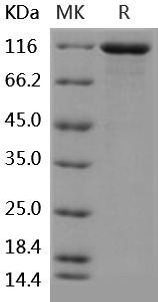 Human VCL/Vinculin Recombinant Protein (RPES0662)