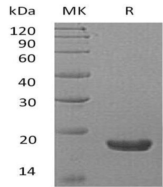 Human TXNDC12/ERp18 Recombinant Protein (RPES0665)