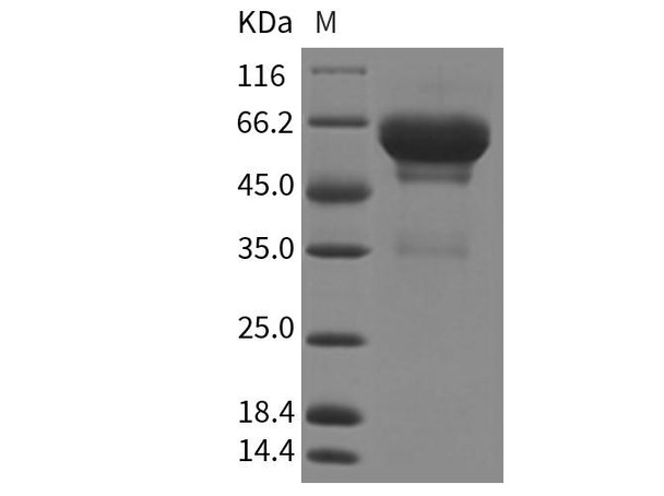 Mouse SCG3/Secretogranin 3 Recombinant Protein (RPES0666)