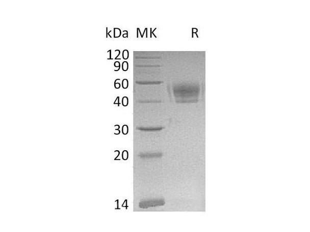 Mouse PD-L1/B7-H1/CD274 Recombinant Protein (RPES0669)