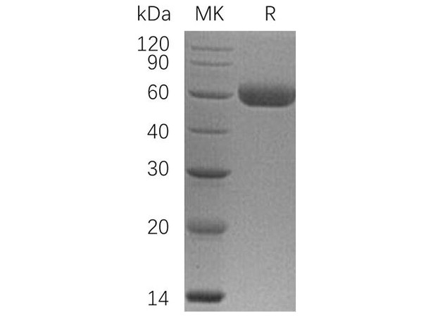 Osteoprotegerin/TNFRSF11B Recombinant Protein (RPES0670)