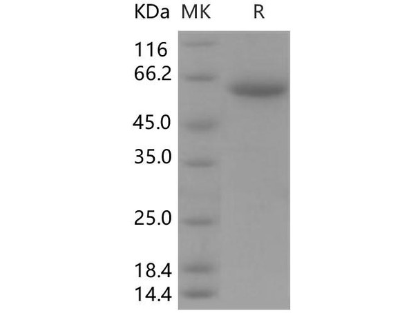 Human CLEC10A/CD301 Recombinant Protein (RPES0675)