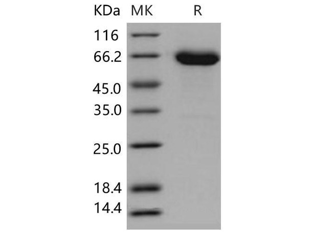 Mouse EphA6/EHK-2 Recombinant Protein (RPES0678)
