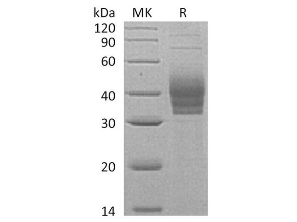 Human CLEC4E/Mincel Recombinant Protein (RPES0681)